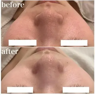 ✨美肌水光✨ アトリエリュバンのエステ・リラクイメージ