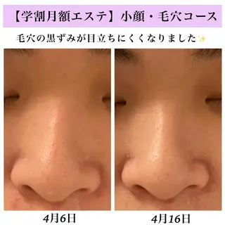 Bellesthe (ベルエステ)のエステ・リラクイメージ