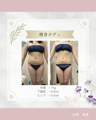 痩身専門エステ addissimoのエステ・リラクイメージ