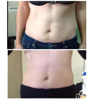 ニキビ・ 肌荒れ専門店のエステ・リラクイメージ