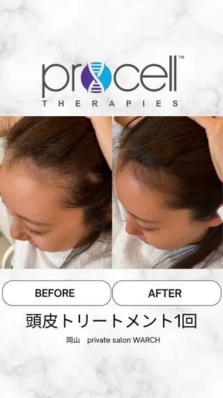 WARCH Marieのその他イメージ