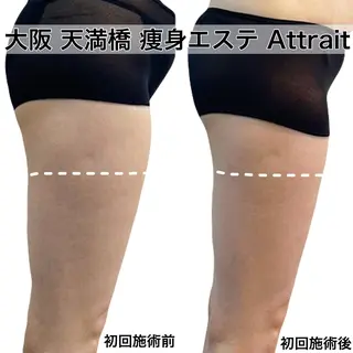 Attrait second body所属・30代体型•不調専門 天満橋Attraitのその他イメージ
