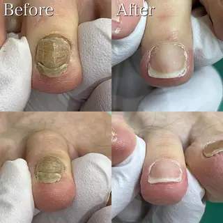 東京巻き爪アカデミー所属・東京巻き爪 アカデミーのエステ・リラクイメージ