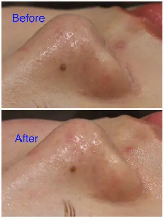 ANRIRE (アンリール)のエステ・リラクイメージ