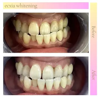 ecxia  white 　広島袋町店所属・セルフホワイトニング エクシア広島袋町店のその他イメージ