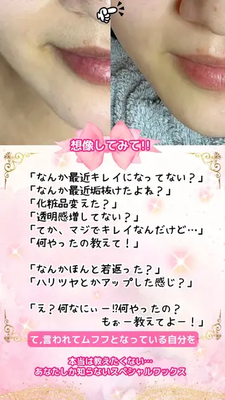 Hit. シュガーリング豊橋のエステ・リラクイメージ