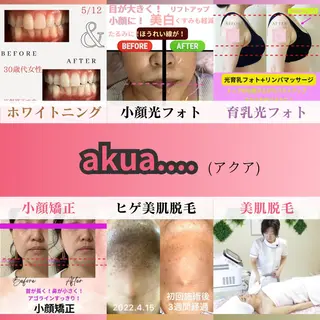akua...痩身・ 脱毛・ホワイトニングのその他イメージ