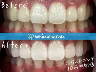 ホワイトニングカフェ中野店所属・ホワイトニングカフェ 中野店のその他イメージ