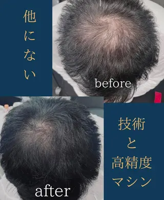 メンズ W eye+東口店/ SCALP INKのマツエク・マツパデザイン