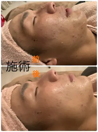 Beauty Salon Mirei所属・Beauty SalonMireiのエステ・リラクイメージ