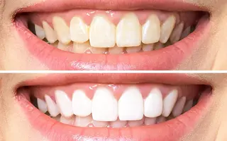 REMENTE🪞 KANAの眉毛・アイブロウイメージ