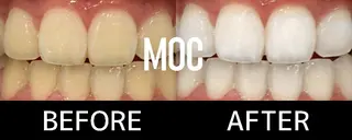 歯科提携セルフダック 宇都宮駒生店のエステ・リラクイメージ