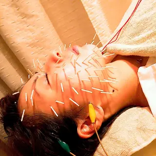 むくみたるみ専門☆ 美容鍼・小顔矯正のエステ・リラクイメージ