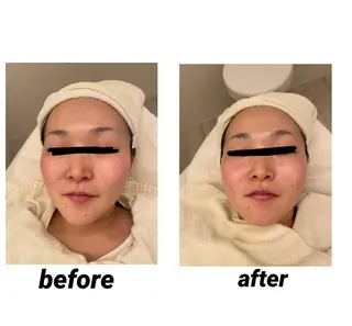 DeI'm   名古屋栄所属・小林 玲菜のエステ・リラクイメージ