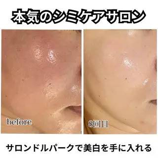 毛穴シミ改善専門 サロンド・ルパークのエステ・リラクイメージ