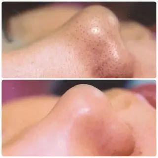 ラ・ルミエール所属・鈴木 えつこのエステ・リラクイメージ