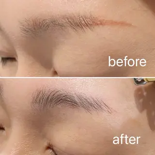 痛くないシミ取り 【荻窪】石橋のヘアスタイル