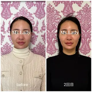 毛穴レス ハーブ& ワックス脱毛×光脱毛のエステ・リラクイメージ