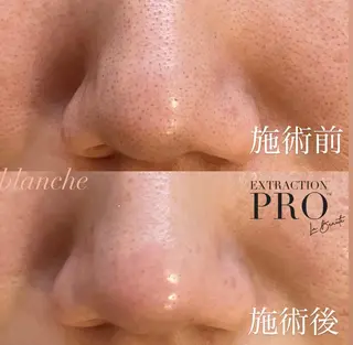 salon blancheのエステ・リラクイメージ