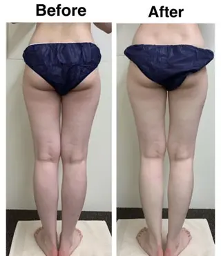 バストケア RAYVIS梅田店Nのエステ・リラクイメージ