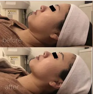 ✨美肌水光✨ アトリエリュバンのエステ・リラクイメージ