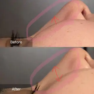 Mandarin Orange所属・毛穴から始める肌メン テマンダリンオレンジのエステ・リラクイメージ