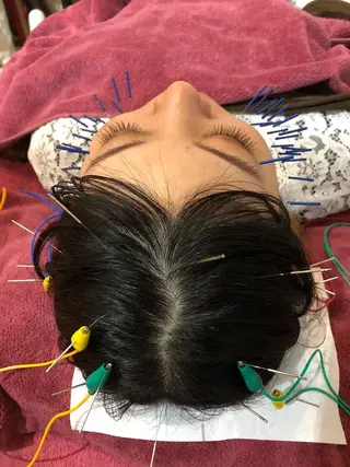 美容鍼灸女性専用 りんご鍼灸治療院のその他イメージ