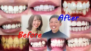 セルフホワイトニングサロン　ラヴィアン所属・ホワイトニングサロン La vie enのその他イメージ