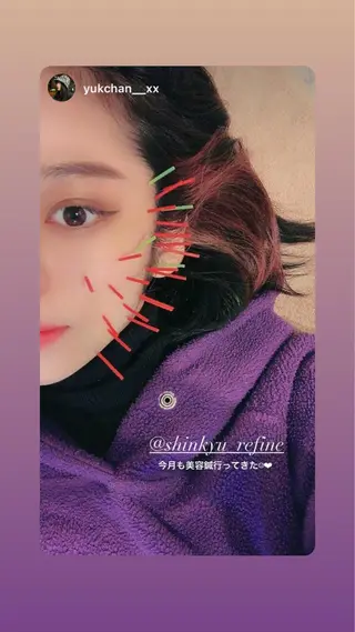 鍼灸整骨院Refine所属・鍼灸 Refineのその他イメージ