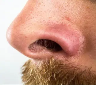 美肌脱毛サロン長居『K-epi』所属・【美肌専門サロン】 美肌脱毛K-epiのエステ・リラクイメージ