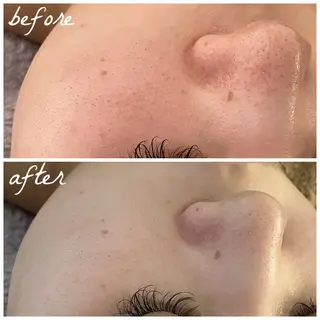 メンズ メナード岐阜茜部 杉浦のエステ・リラクイメージ