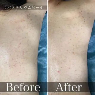 メンズ歓迎🙆‍♀️ エステ/ネイルISTのエステ・リラクイメージ