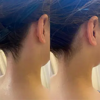 BELCIA福岡店　récolte de BELCIA（レコルトデベルシア）所属・BELCIA福岡店 レコルトデベルシアのエステ・リラクイメージ