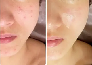 最速小顔・肌質管理 ❣️エスポワールのエステ・リラクイメージ