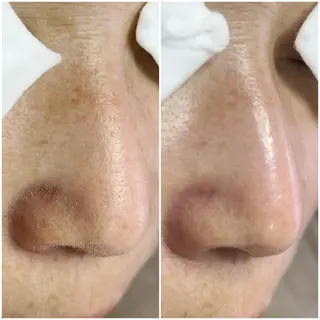 毛穴洗浄専門店/ 泉佐野/oluoluのエステ・リラクイメージ