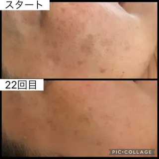 Bright所属・Brightブライト (エステ.リラク)のエステ・リラクイメージ