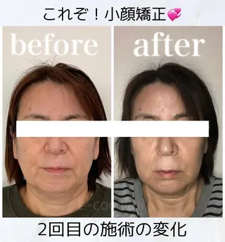 小顔と ヘッドスパのお店のエステ・リラクイメージ