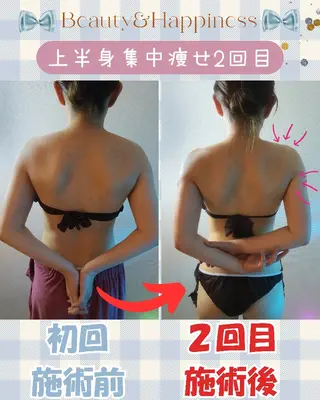 痩身ハーブピーリング 筋膜リリース☆B&Hのエステ・リラクイメージ