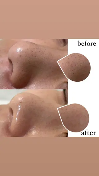 女性専門お顔剃り sunraineのエステ・リラクイメージ