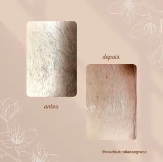 ブラジリアンワックス グレイスのエステ・リラクイメージ