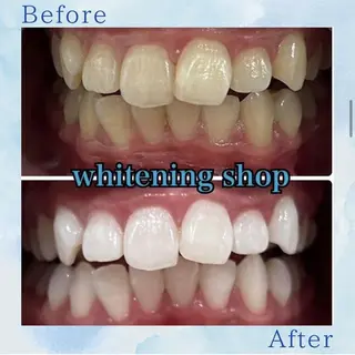 ホワイトニング ショップ葛西店のその他イメージ