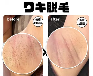 ローザエメ Reiaのエステ・リラクイメージ