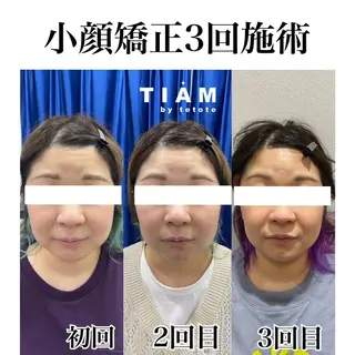 美肌サロンTIAM by tetoteのエステ・リラクイメージ