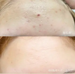 beauty salon Belle所属・Belle【ベル】 YUKA⸜🌷︎⸝‍のエステ・リラクイメージ