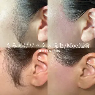 HOTEL&PARK .Moeワックス脱毛のエステ・リラクイメージ