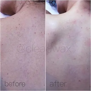 CLEAD 赤坂見附店のエステ・リラクイメージ