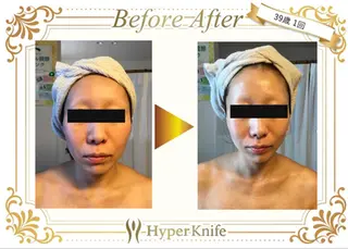 所沢痩身小顔コルギ AromaQueenのエステ・リラクイメージ