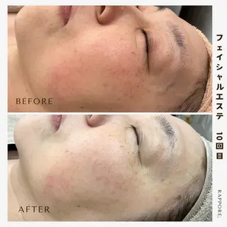 Rappore; 心斎橋　みずきのエステ・リラクイメージ