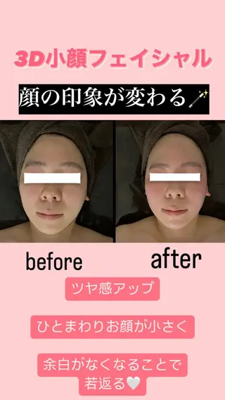 美骨＆小顔矯正サロン　Clarte所属・骨から若返る美骨＆ 小顔サロンクラルテのエステ・リラクイメージ