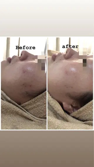 セミロング カラー パーマ ヘアアレンジ メンズ キッズ ネイル マツエク・マツパ Amaryllis 🌹のエステ・リラクイメージ